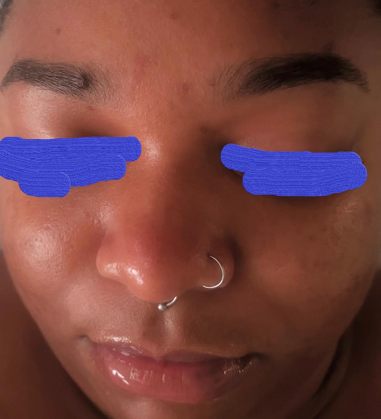 Client skin after brightening facial — reduced dark spots and improved tone