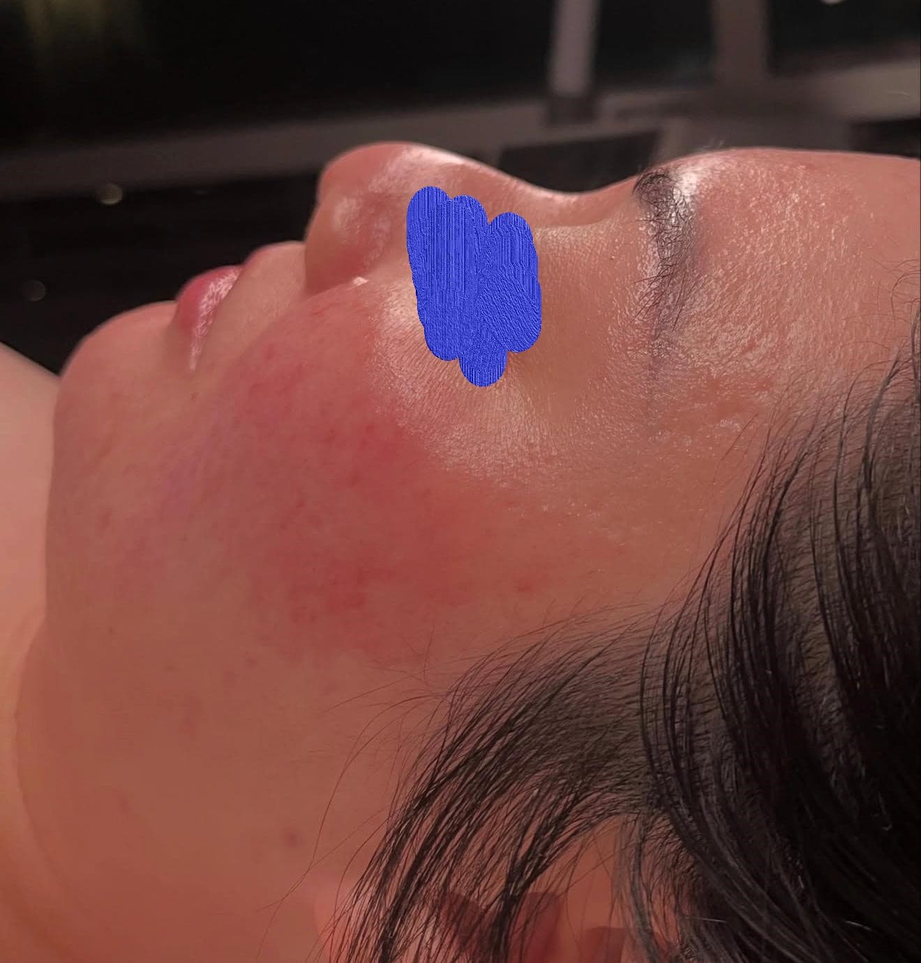 Client skin after professional skincare treatment — visibly refreshed and even tone