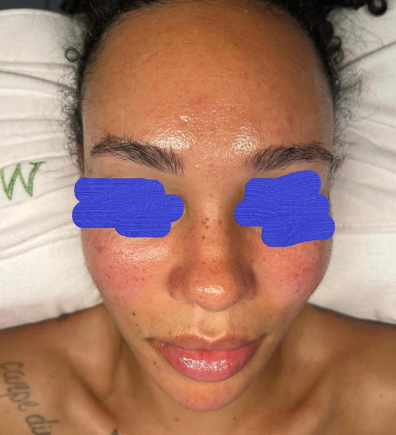Client skin after deep cleansing facial — refined pores and clarified skin